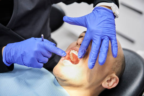Best Emergency Dental Extractions in Glenwood Landing, NY